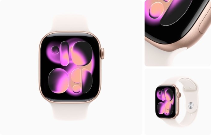 Apple Watch Series 11 màu Vàng