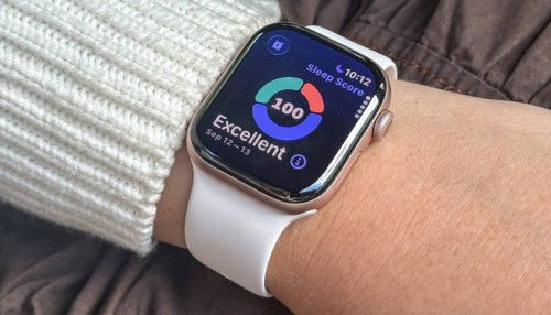 Apple Watch Series 11 có mấy màu? Nên mua màu nào đẹp?