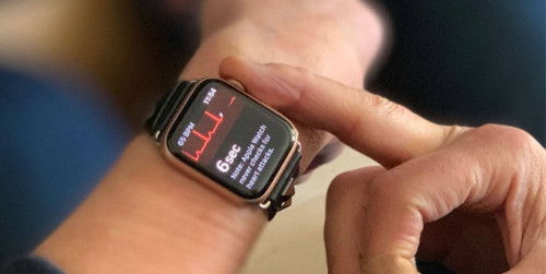 Tính năng ECG của Apple Watch có thể dùng được tại Việt Nam vào tuần tới